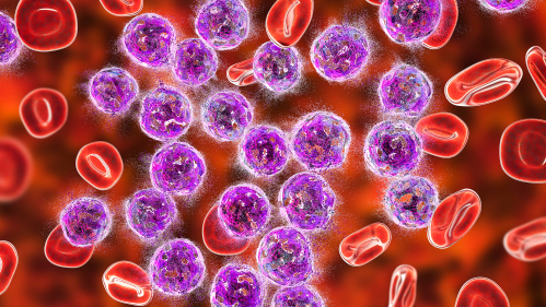 leukemia cells amid normal blood cells