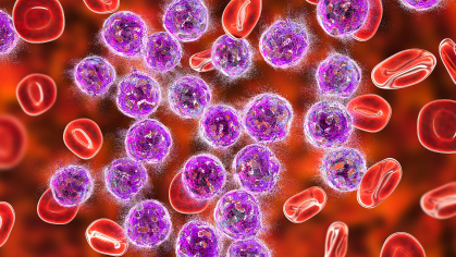 leukemia cells amid normal blood cells